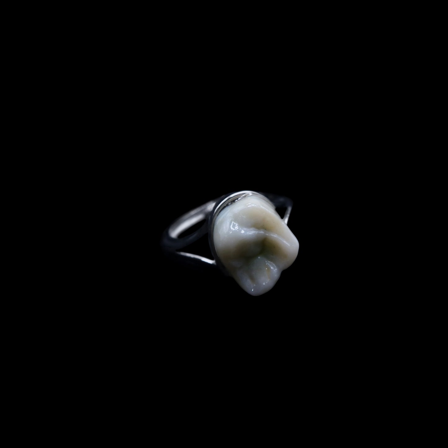 Filled Cavity Molar Ring