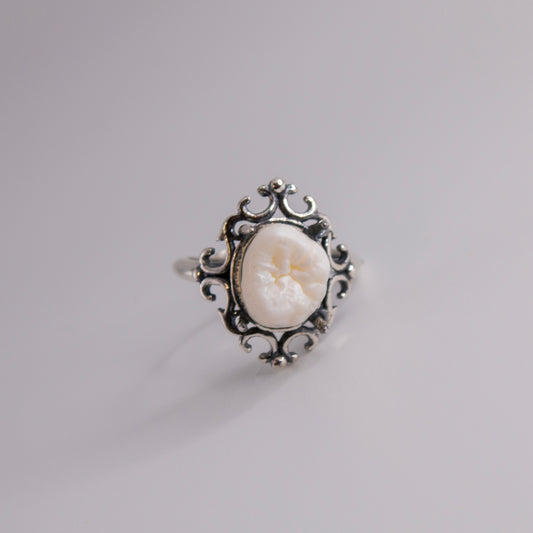 Filled Cavity Molar Ring
