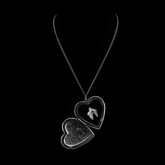 Loose Tooth Locket