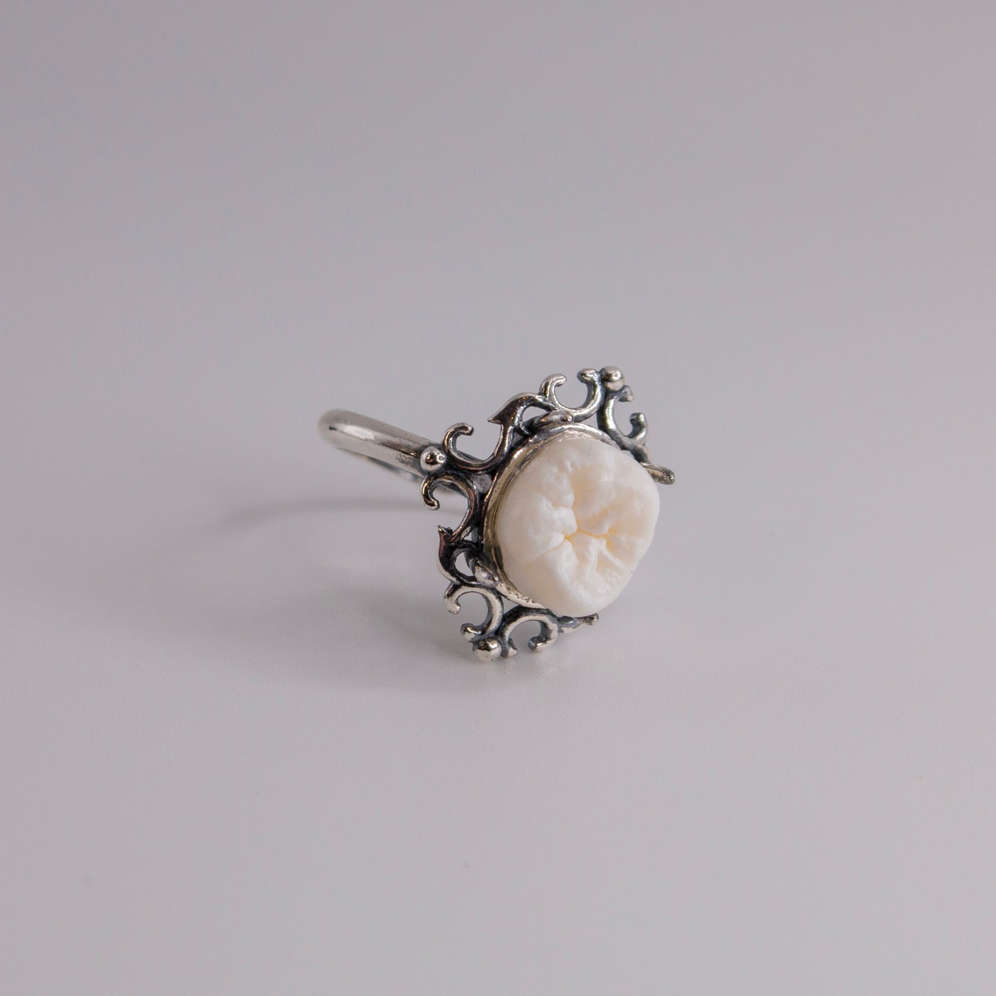 Filled Cavity Molar Ring