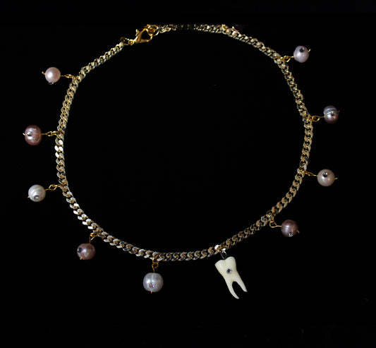 Sweet Tooth Choker