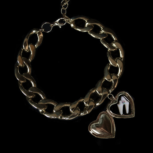 Loose Tooth Locket Bracelet